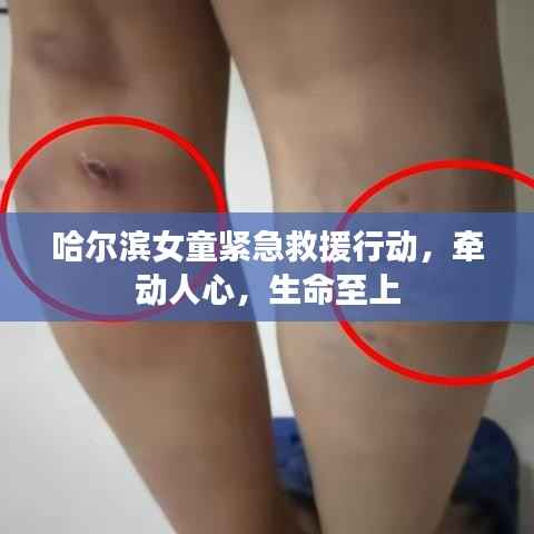 哈尔滨女童紧急救援行动,牵动人心,生命至上