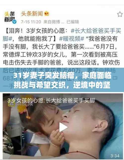 31岁妻子突发脑瘤,家庭面临挑战与希望交织,逆境中的坚守与希望之旅